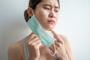 maskne acne pimples under mask asian woman