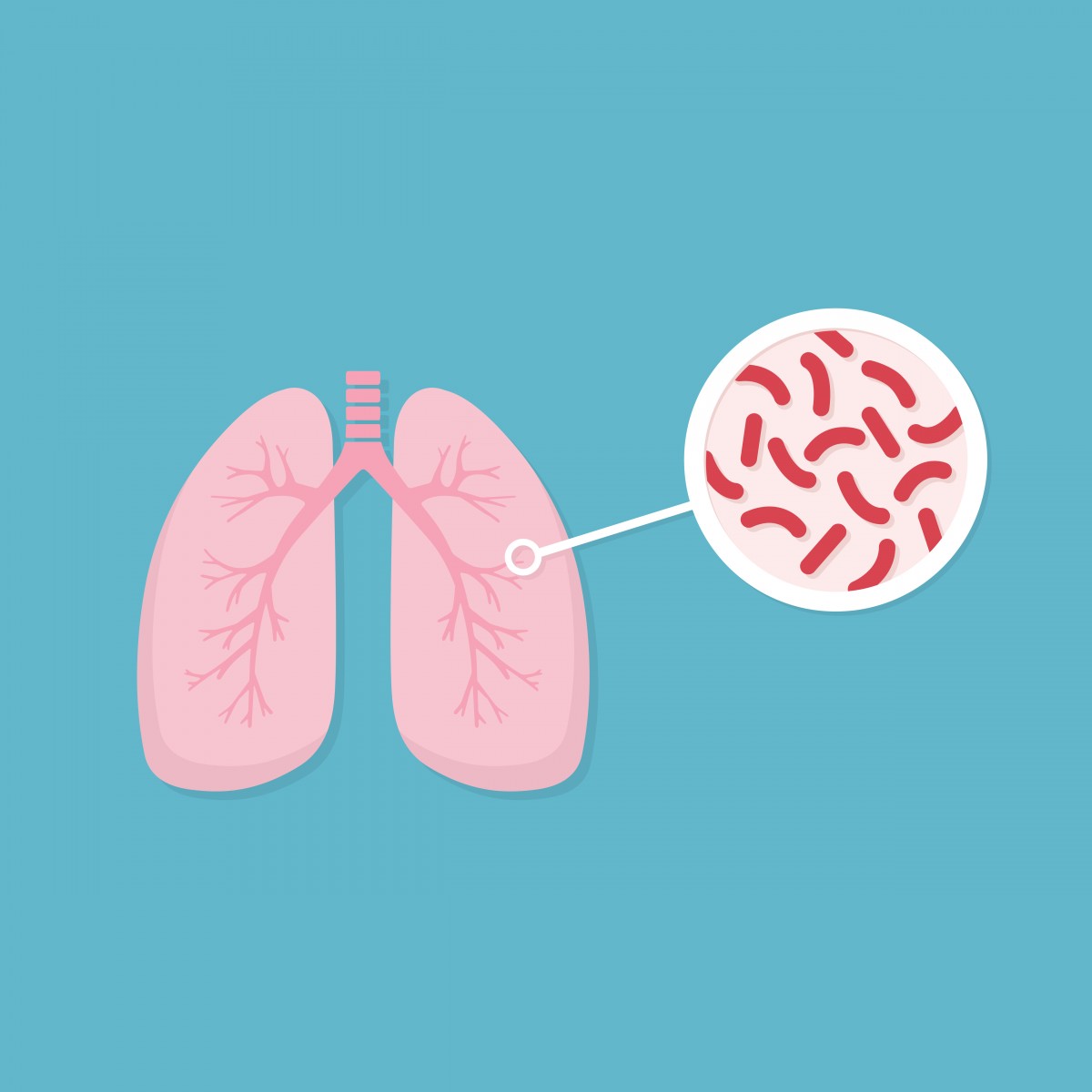 Tuberculosis: the tug with COVID-19