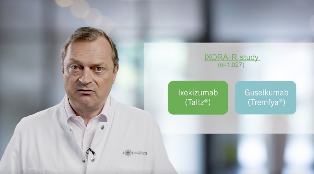 IXORA trial: Comparison Between Ixekizumab and Guselkumab for Plaque Psoriasis