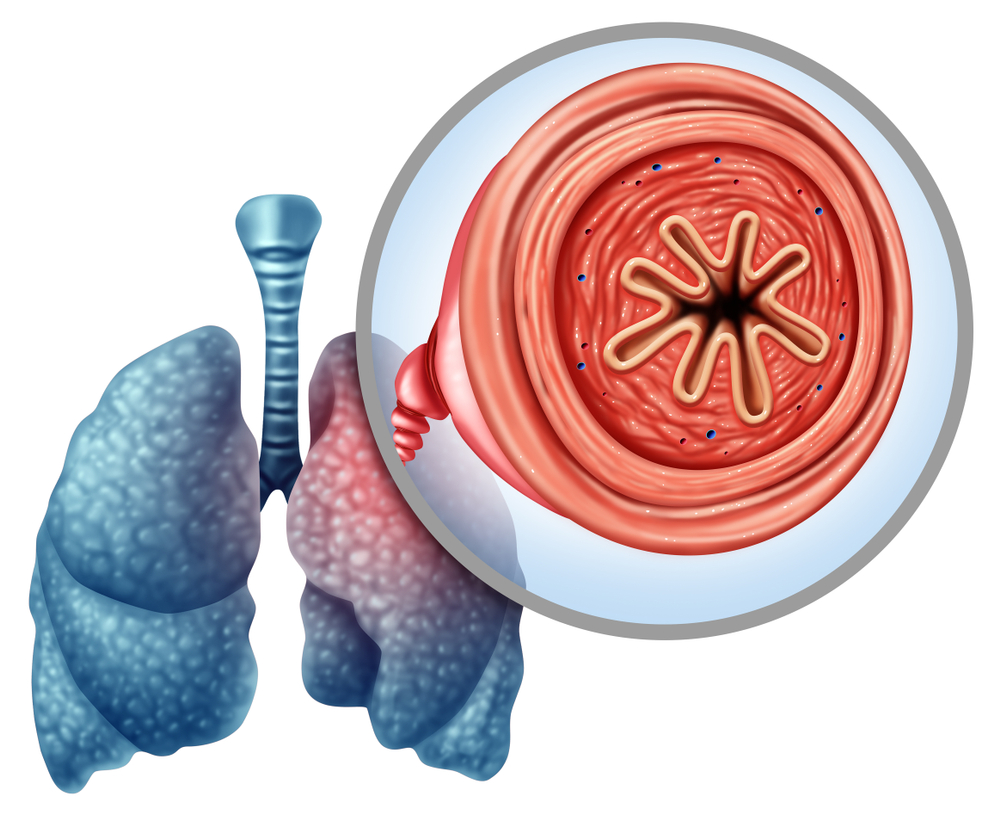 COPD: Everything You Need To Know About It