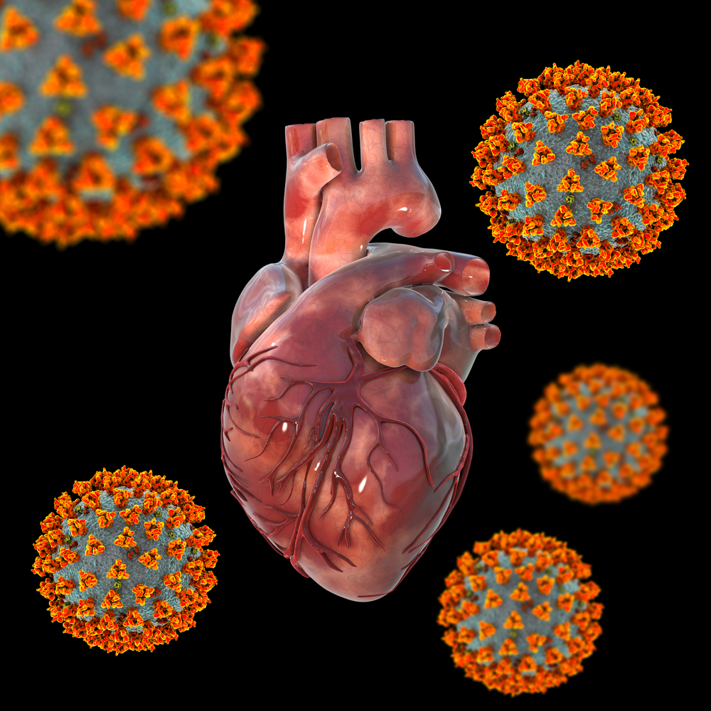 Heart Complications: COVID-19 Infections vs Vaccination – Which Is Worse?