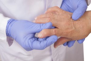 upadacitinib rinvoq treatment for rheumatoid arthritis (RA)