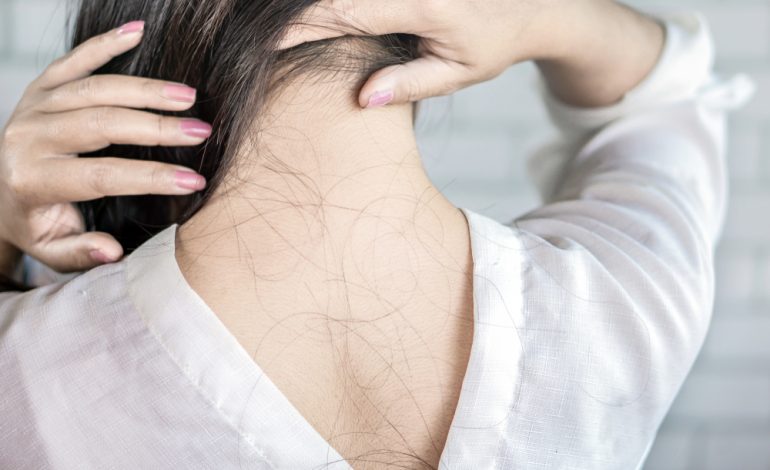 Alopecia: All You Need To Know