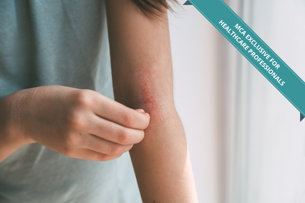 HSA Approves New JAK inhibitor Abrocitinib (Cibinqo) For The Treatment of Atopic Dermatitis