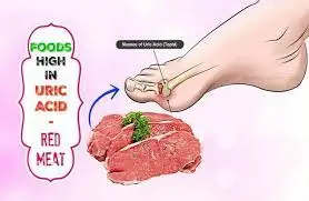 red meat gout