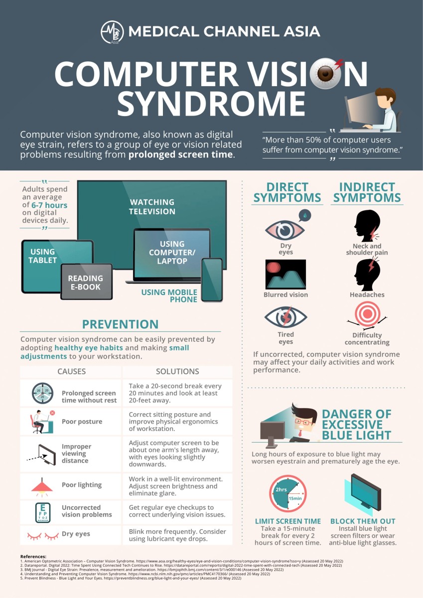 computer vision syndrome infographic
