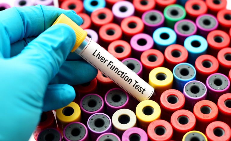 Types of Liver Function Tests