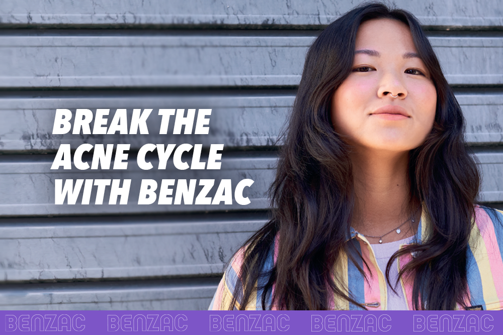 Break the Acne Cycle with Benzac