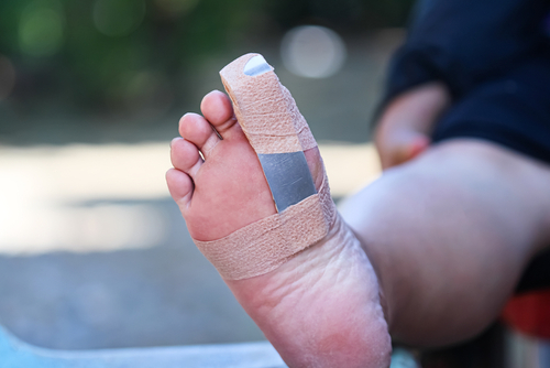 Hallux Limitus: A Painful Condition That Affects Your Big Toe Joint