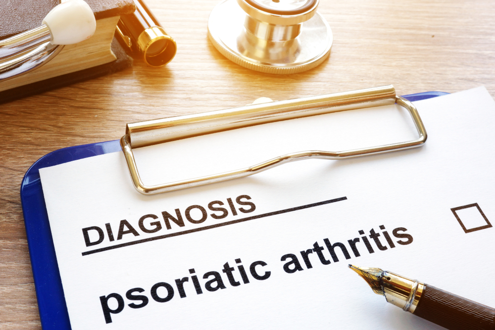 Latest Psoriatic Arthritis Trial Promising: 20% Symptom Reduction With Brepocitinib