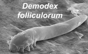 Demodex mites live in the follicles of the skin, especially around the eyelids and lashes and feed on dead skin and oils.