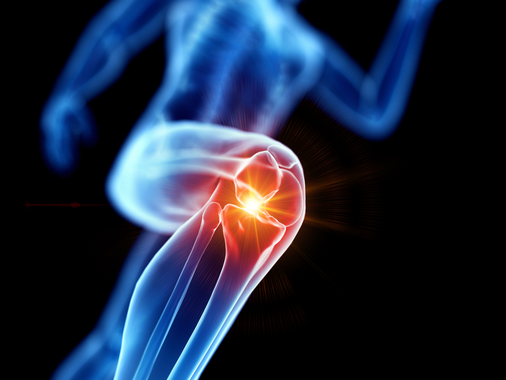 Knee Pain: When to See a Doctor