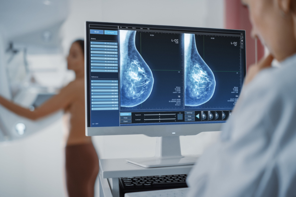mammogram radiology