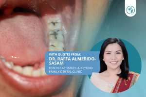 tooth brushing cavities dr raffa Almerido-Sasam