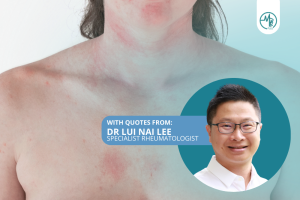 Lupus Dr Lui Nai Lee