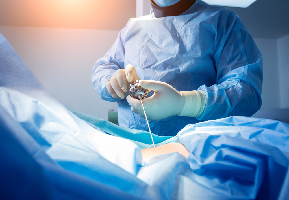 A Comprehensive Guide to Endoscopic Spinal Surgery: Procedure, Benefits, and Aftercare