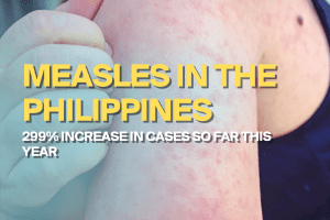 measles philippines