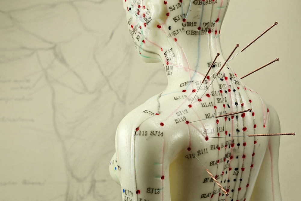 Acupuncture in Healthcare: An Analysis