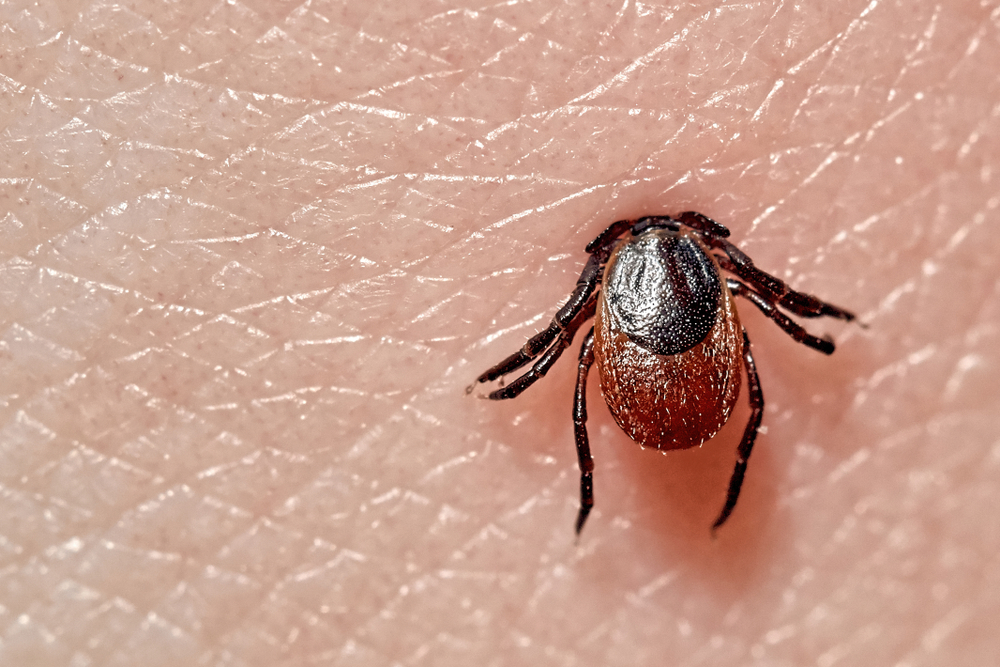 Lyme Disease Cases in Asia: Understanding the Under-Reported Threat