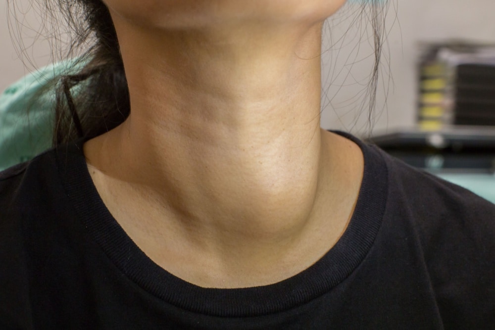 A Comprehensive Guide to Understanding Thyroid Nodules and Their Impact on Health