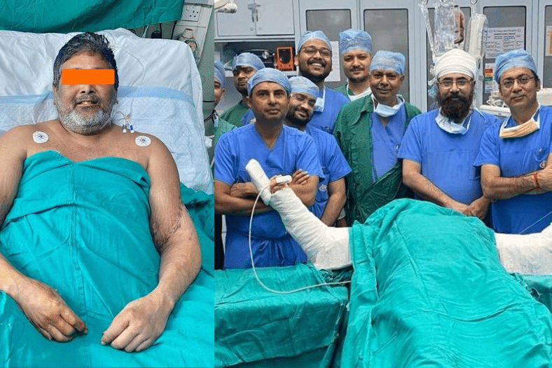 Delhi Man’s Life Transformed Through North India’s First Successful Bilateral Arm Transplant