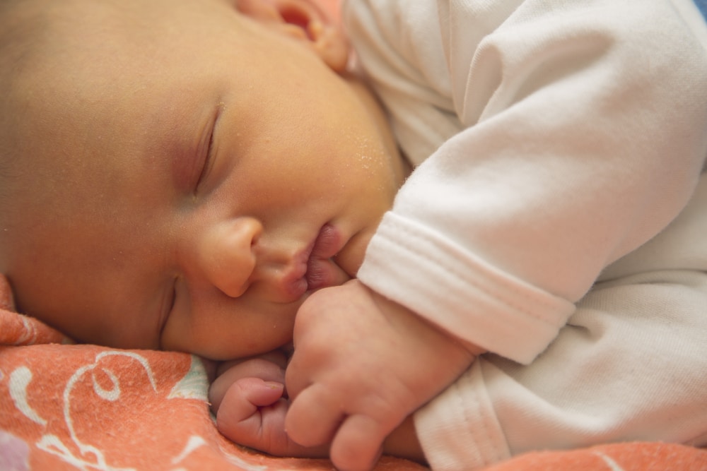 Understanding Jaundice: Why It’s Common in Newborn Babies