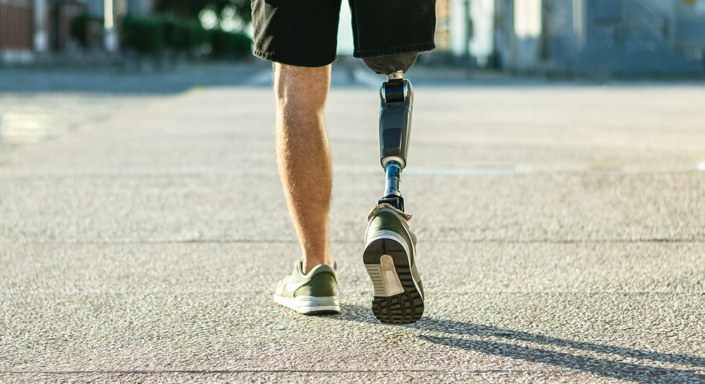 New Nervous System-Driven Prosthesis Helps Amputees Walk Naturally