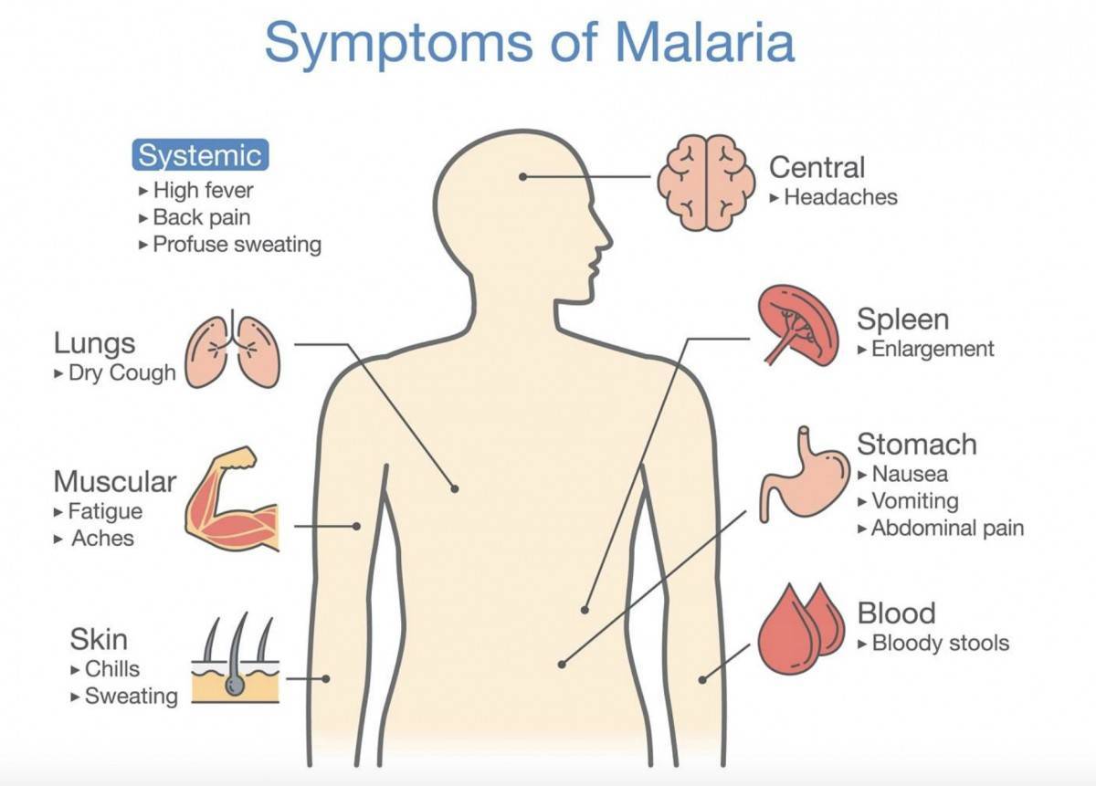 malaria symptoms