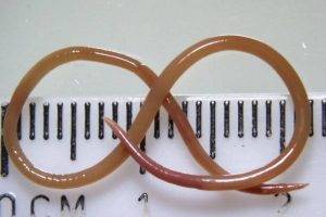 They find an eight centimeter worm in the brain of
