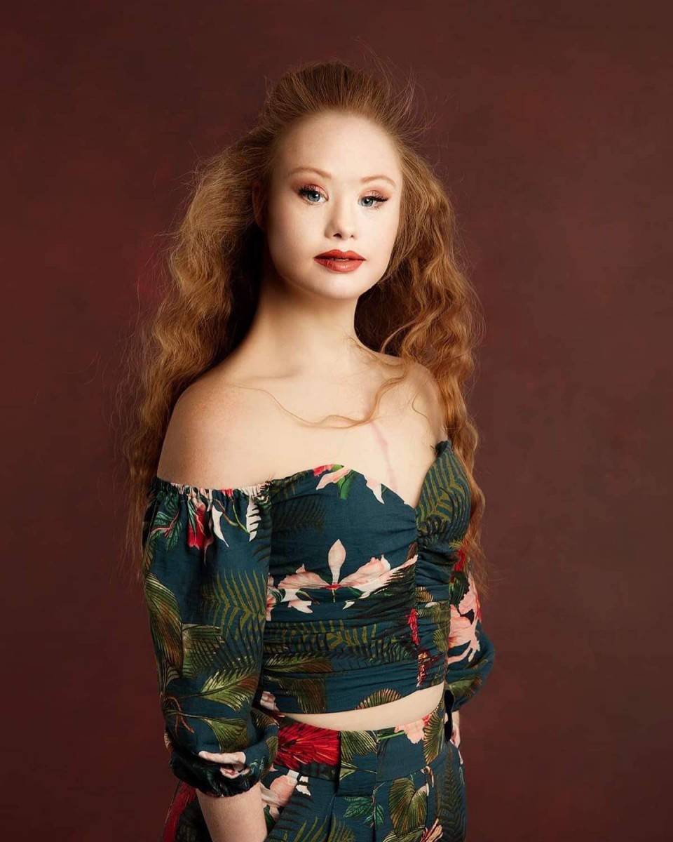 madeleine stuart model down syndrome