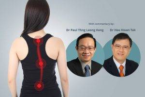 scoliosis in teenage girls singapore