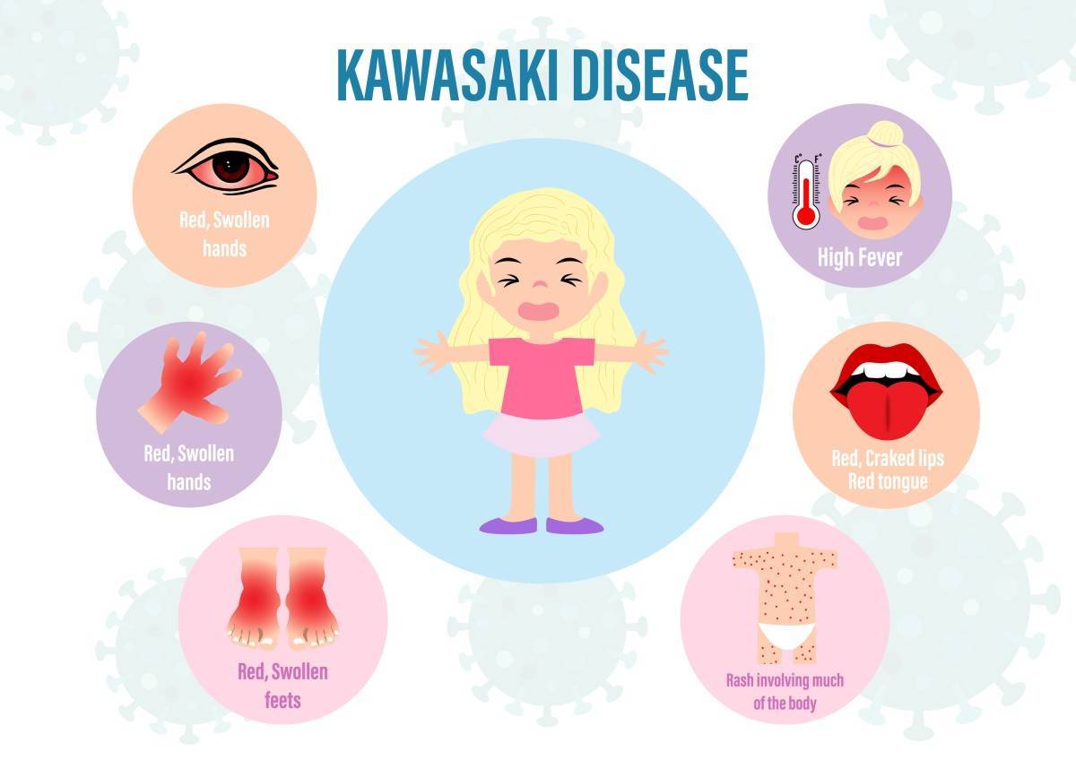 Kawasaki disease