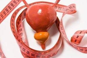Measurement,Of,Bladder,And,Prostate,As,Definition,Of,Symptom,Or