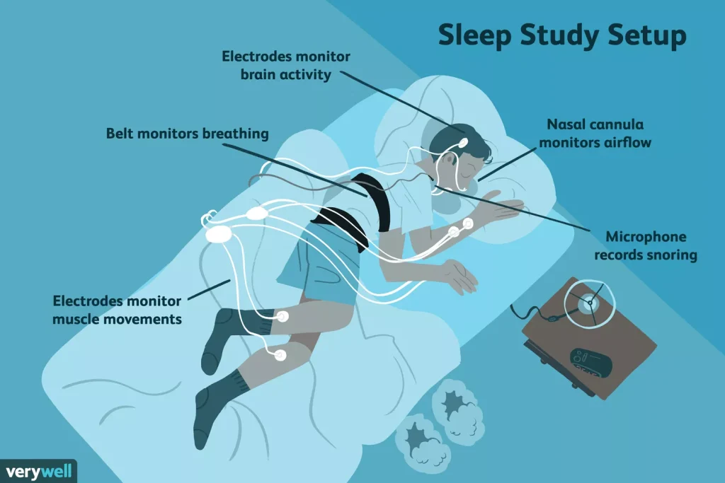 Sleep Study Setup