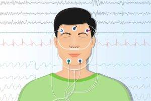 what to expect from a sleep study