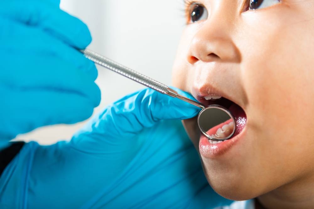 Dental,Kid,Health,Examination.,Asian,Dentist,Making,Examination,Procedure,For