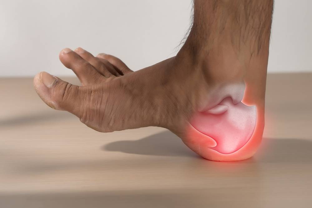 A,Man,Has,Heel,Pain,Due,To,Plantar,Fasciitis