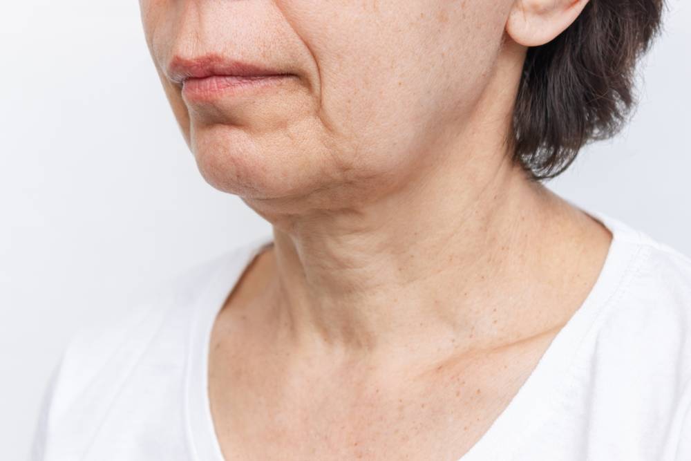 The,Lower,Part,Of,Elderly,Woman's,Face,And,Neck,With