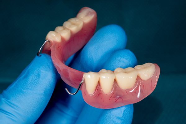 Why Modern Partial Dentures Feel So Natural - Medical Channel Asia
