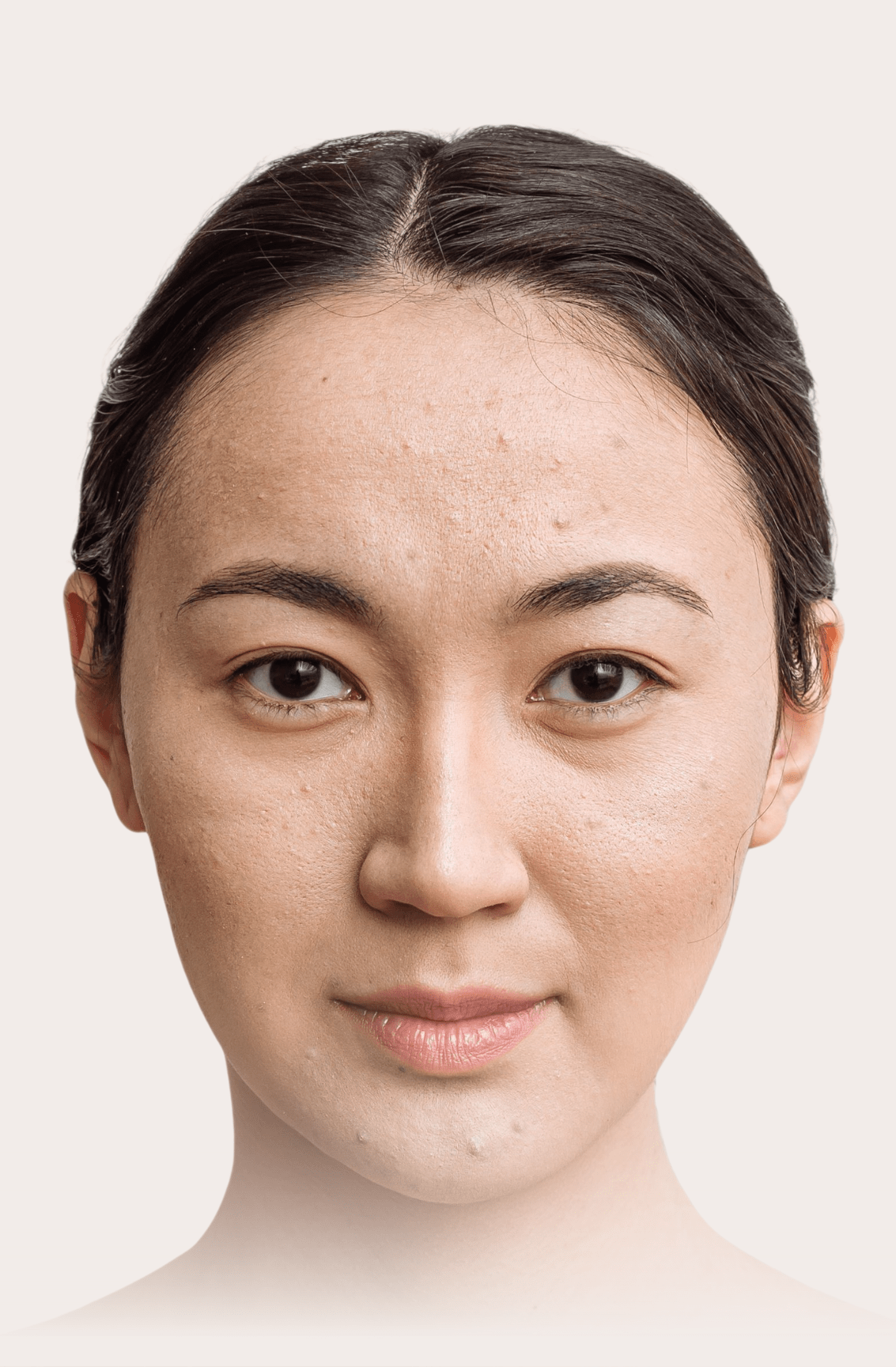 woman with aesthetics condition