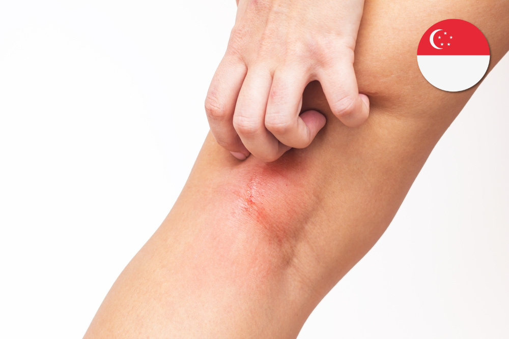 Inside the Itch: How Skin, Nerves, and Immunity Misfire in Eczema