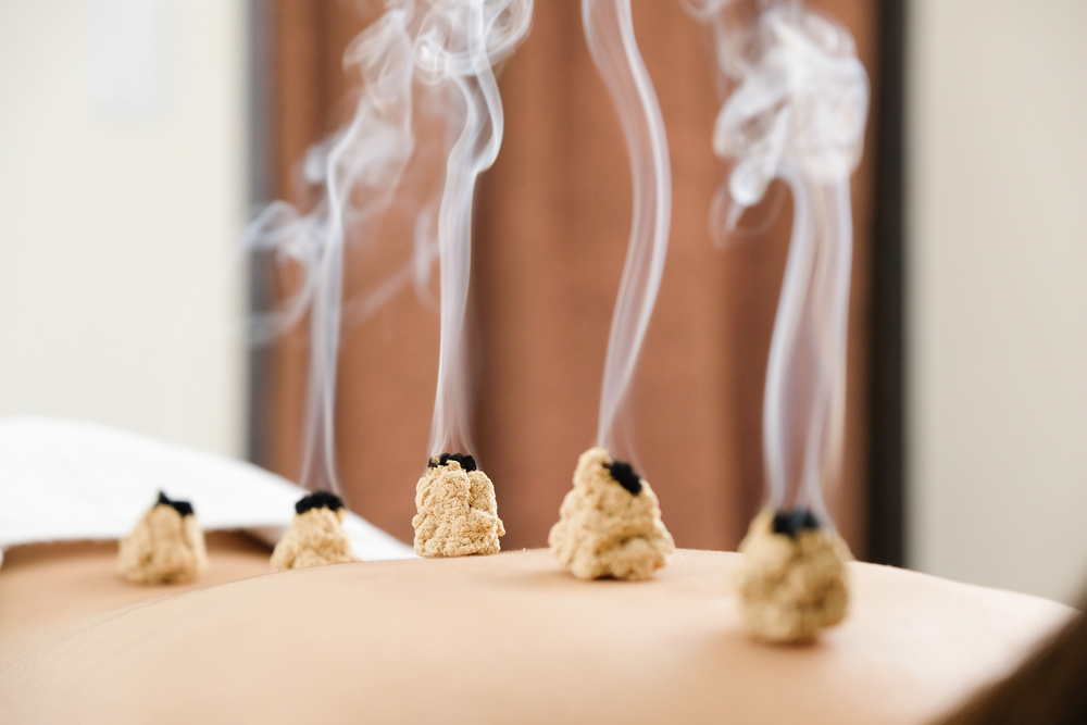 Moxibustion’s Warm Promise (and Scientific Limits)