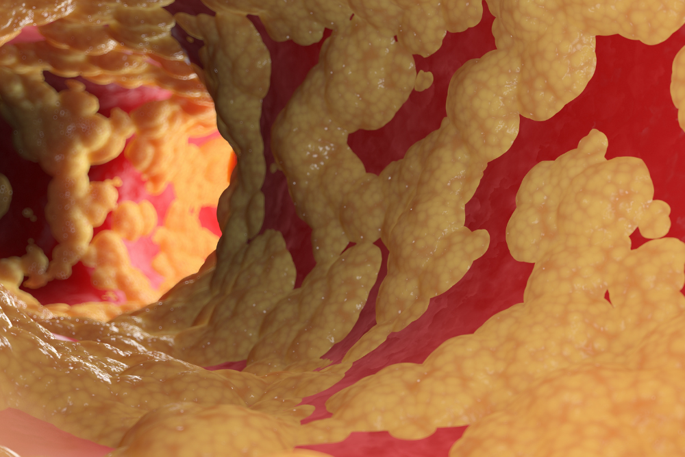 Hidden Belly Fat Could Be Raising Your Health Risks