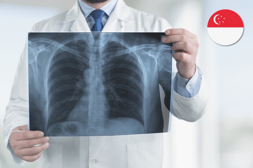 Asian-Specific Multimorbidity Significantly Amplifies Asthma and Copd COPD in Singapore, With Healthcare Burden Projected in the Billions Over the Next Two Decades